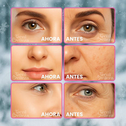 ❄️GLOBOS DE HIELO SKINFREE™ - Tu rutina facial de lujo al instante 💎